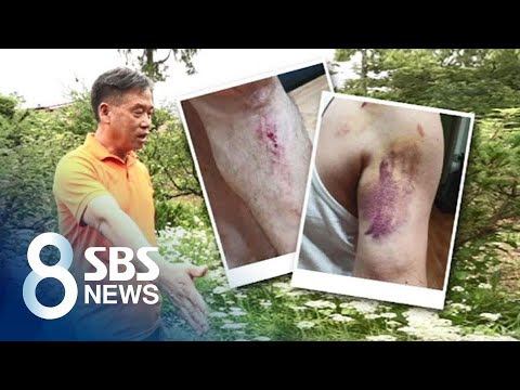 &amp;#39;쇠파이프 폭행&amp;#39; 당하고 2달 뒤에 또…피의자는 &amp;#39;입 꾹&amp;#39; / SBS