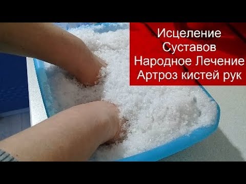 Косточки на руках лечение в домашних условиях