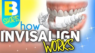 How Invisalign Works #shorts