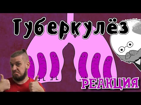 Лечение Туберкулеза -