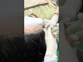 #Dreamhairline #hairrestoration #hairtransplantseoul #stemcellhairtreatment #hairtreatment