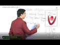 Aortic stenosis / Aortic valve disease : Pathophysiology Usmle step 1