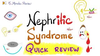 Nephritic Syndrome | APSGN, RPGN, IgAN, Alport | Quick Review | 5- Minute Review Series