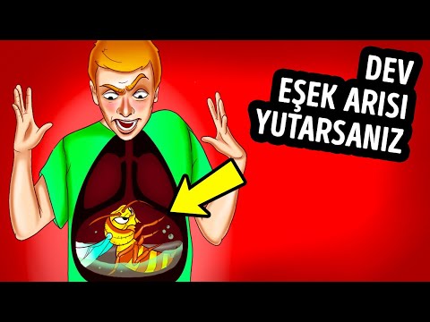 Bir Eşek Arısını Yutarsanız ve Sizi Sokarsa Ne Olur