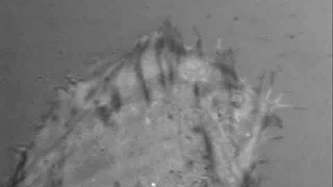 Step Two of Cell Movement: Adhesion