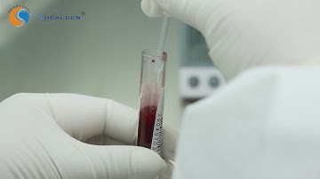 COVID-19 IgG/IgM Rapid Test Cassette Instruction