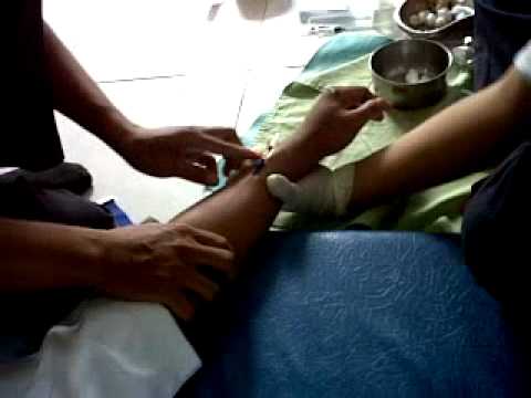 Expresi Gokil Saat Di Infus Youtube