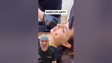 Do Her Dimples Look Real? 🤔