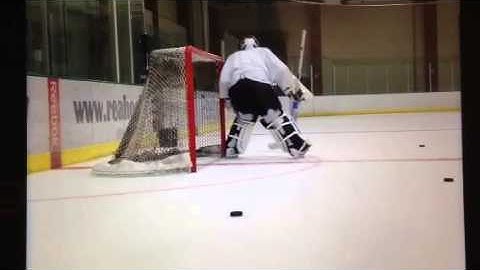 VH transition into RVH