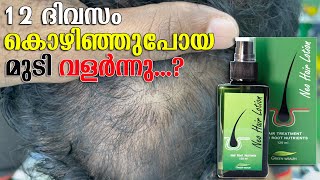 NEO HAIR LOTION FASTEST RESULT WITH IN 12 DAYS | Hair Root nutrients | അതി വേഗം തലമുടി വന്നു