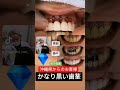 沖縄県からのお客様を即日6歯美しくいたしました✴️大阪前歯セラミック矯正専門ダイヤモンド今井院長#セラミック#沖縄県#セラミック矯正