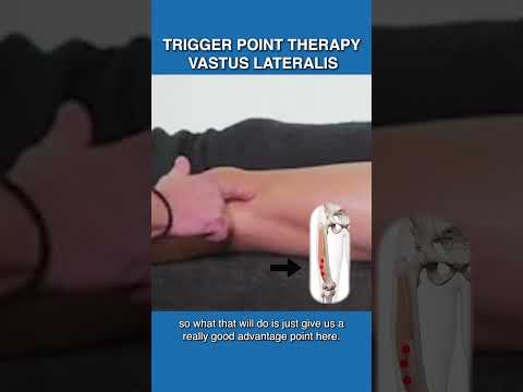 וִידֵאוֹ: האם vastus medialis quadriceps?