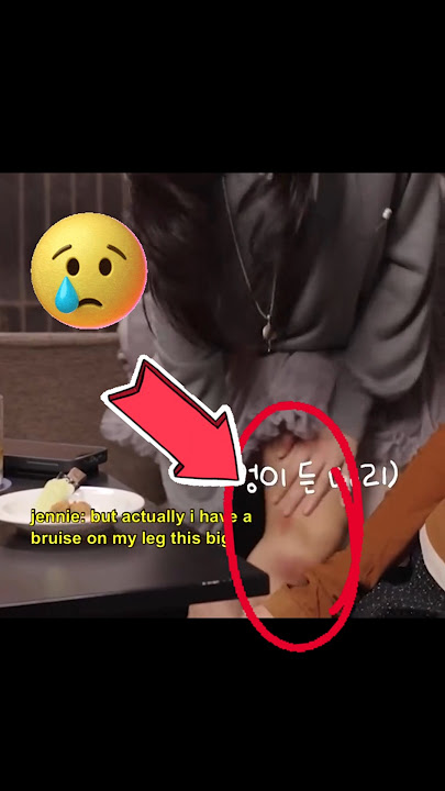 Jennie's legs started bleeding 😱😭 #jennie #sad #fypviralシ #ytshorts #blink @jennierubyjane