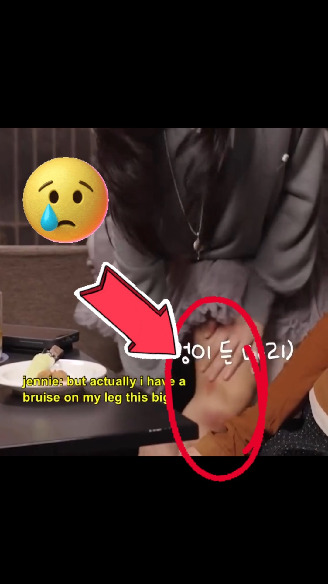 Jennie's legs started bleeding ?? #jennie #sad #fypviralシ #ytshorts #blink @jennierubyjane