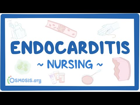 Video: Gdje se endokarditis nalazi u tijelu?