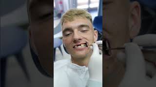 Dental implants and crowns full mouth makeover Turkey