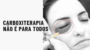 Quanto tempo dura o efeito da carboxiterapia no rosto?