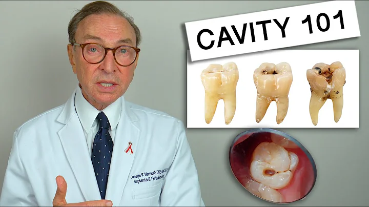 What Causes Tooth Decay? Cavity 101 | Causes | Treatment - DayDayNews