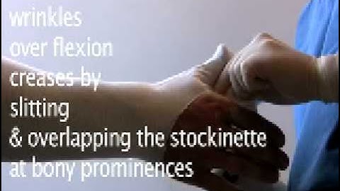 Thumb Spica Splint Application