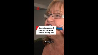 Gum disease and cavities increase stroke risk by 86%