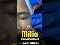 ✨ Say goodbye to stubborn milia! ✨Safe, gentle, and effective removal for smooth, clear skin.