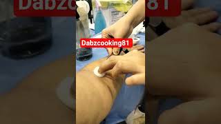 CBC blood test #shortvideo