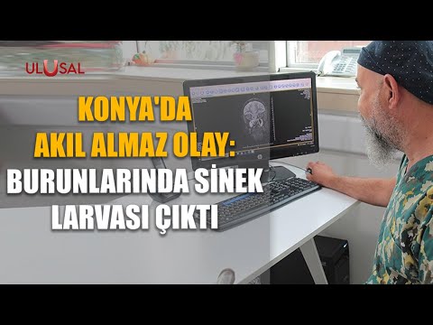 Konya'da akıl almaz olay: Burunlarında sinek larvası çıktı