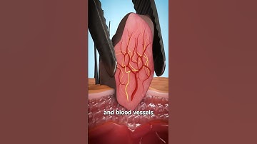 Thumbnail of What Is A Skin Tag? 😨