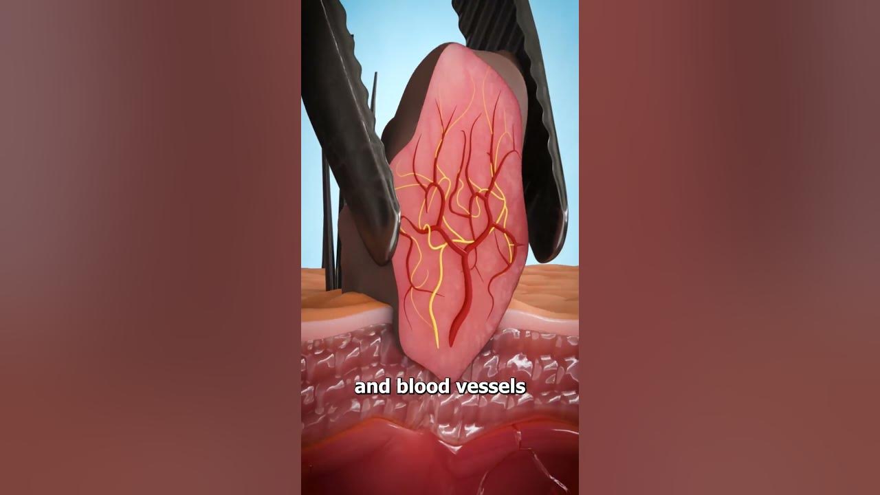 What Is A Skin Tag? 😨