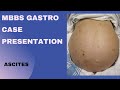 MBBS Gastro Case Presentation