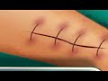 ASMR video/ foot surgary animation #asmr  #satisfying #nkasmr
