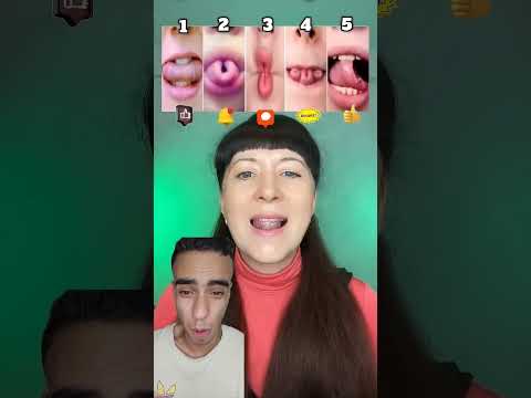 بتعرف تعمل اي حركه انت