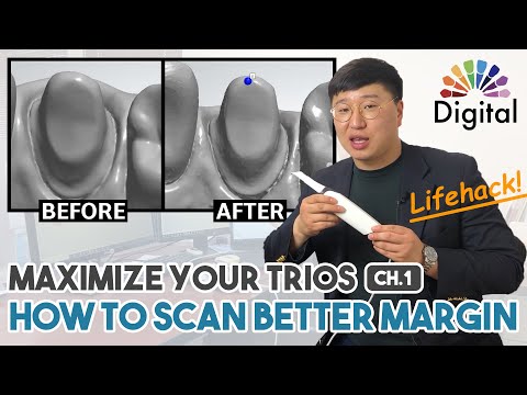 Digital Highlight - “Maximize your TRIOS” Ch 1. How to Scan Better Margin