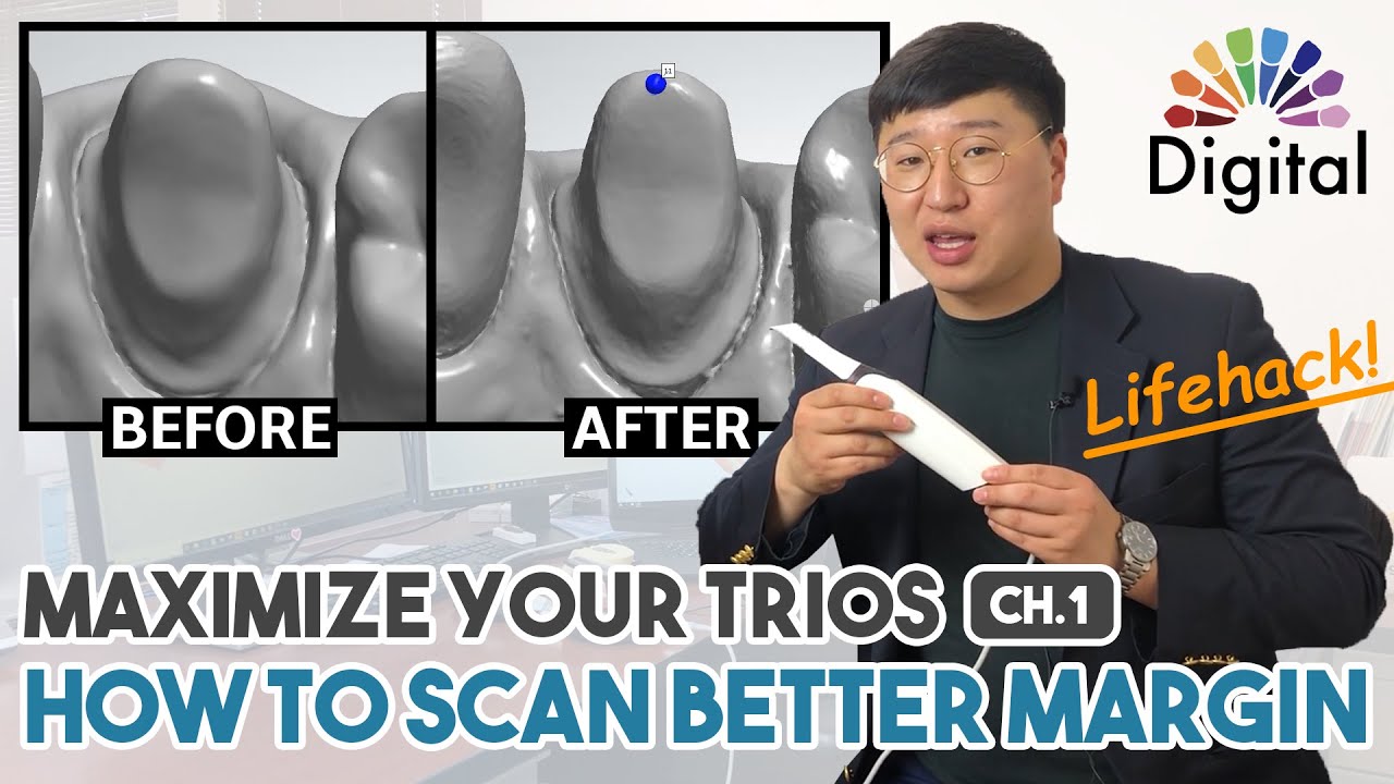 Digital Highlight - “Maximize your TRIOS” Ch 1. How to Scan Better Margin