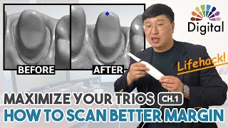 Digital Highlight  “Maximize your TRIOS” Ch 1. How to Scan Better Margin