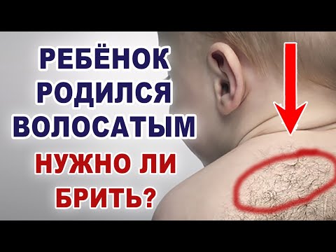 Как убрать пушок и волосы на теле младенца? Выкатывать ли хлебным мякишем? Как волосы мешают?