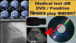 MRI,CT SCAN,USG, Angiogram ইত্যাদি Medical test এর DVD/ Pendrive এ থাকা image/video কিভাবে দেখবেন ?