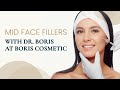 Mid face fillers with dr boris at boris cosmetic