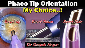 Phaco Basics:-Phaco Tip Orientation Bevel Up, Bevel down..? My preference - Dr Deepak Megur