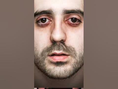 Смерть от бессонницы на Youtube (Фатальная семейная бессонница) - YouTube