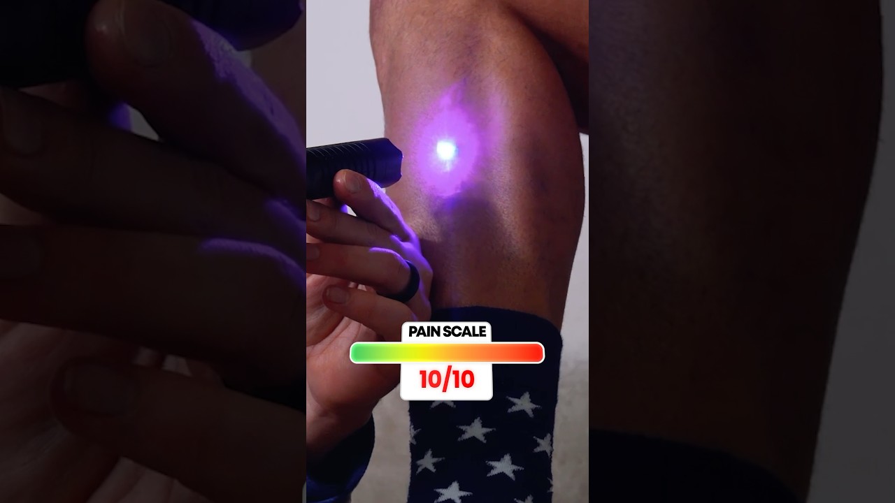 Catching Myself on FIRE with a Laser... #funny #science #shorts