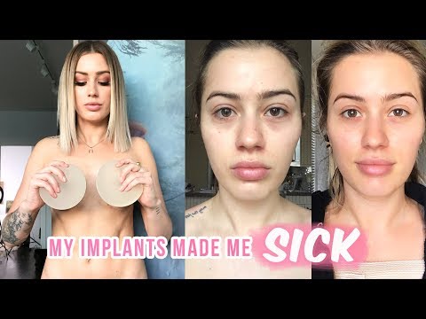 Video: Nobody Asked For A Triangular Shape Yet: The Surgeon Told The Whole Truth About The Silicone Breast