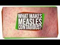 Why Is The Measles Virus So Contagious?