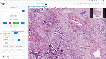 EXACT Registration Feature