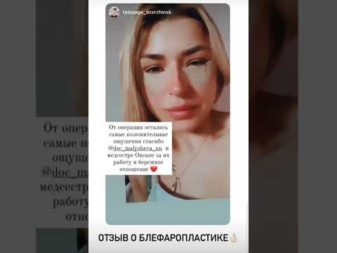 Отзыв по блефаропластике