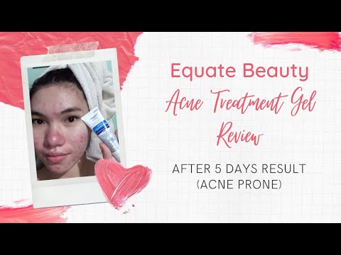 Equate Acne Treatment Gel Review (for Acne-Prone skin) - YouTube