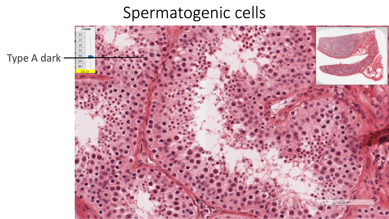 Histology with Chimmalgi: Testis