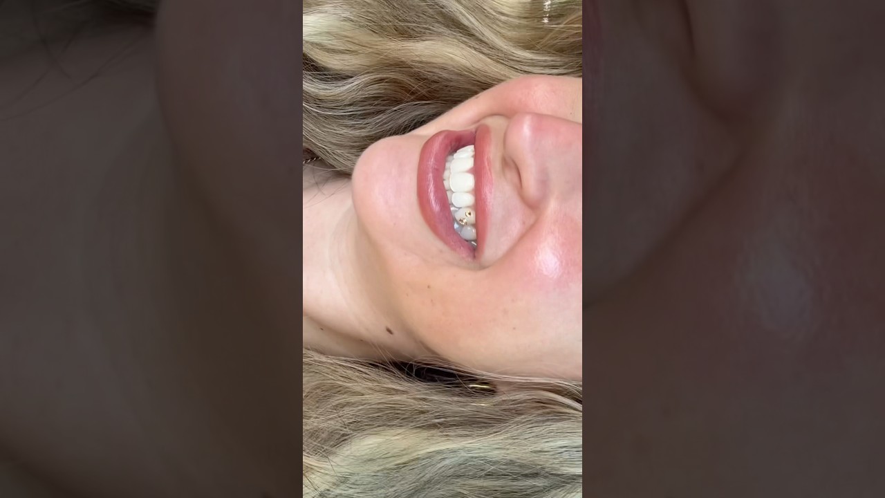 Bling it on babes 🦷💎