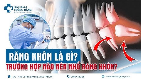 Răng khôn là gì? Khi nào nên nhổ răng khôn? (wisdom teeth)