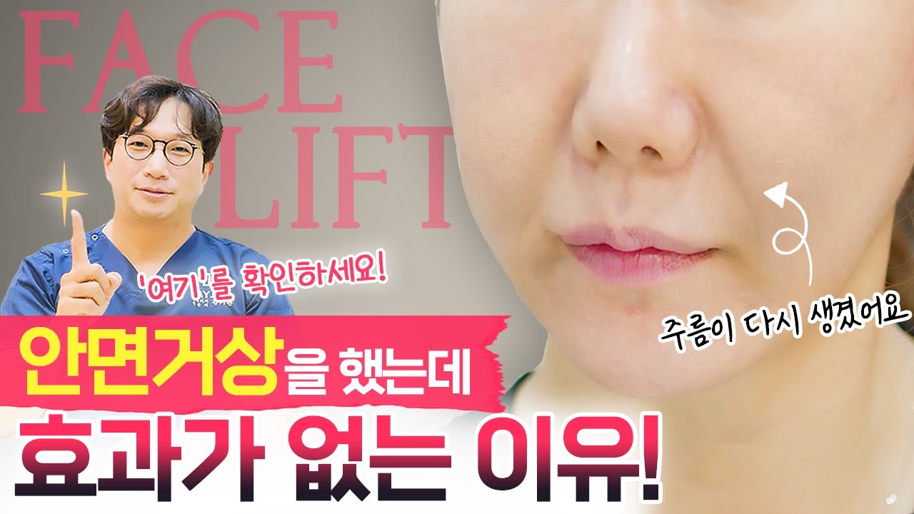 [Thẩm mỹ viện da liễu Jayjun] Lý do tôi là người duy nhất không hiệu quả với phẫu thuật căng da mặt!